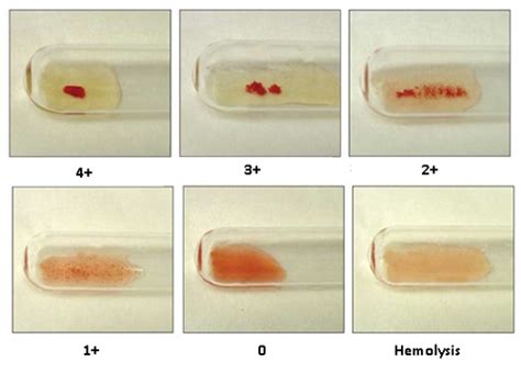 PennVet | Penn Vet Research Shows Success for New Testing Methods for Blood Compatibility, Typing