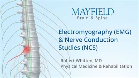 Nerve conduction test lower back pain - bdarocks