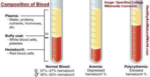 Hematocrit (Hct) Blood Test: Low or High Hct Levels Meaning