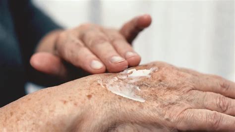 Best arthritis cream: Types, side effects, and when to seek help