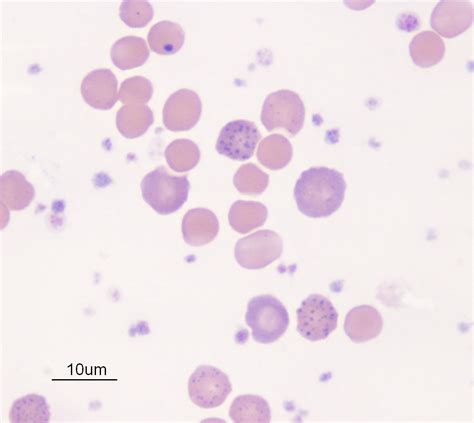 regenerative anemia ruminant | eClinpath