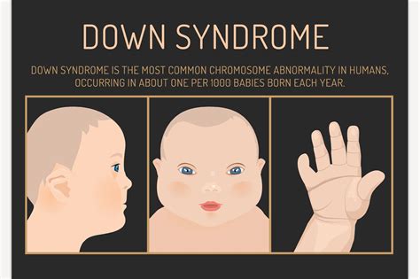 Down Syndrome System Disorder Template