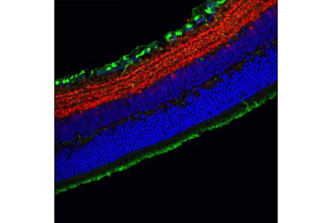 GAD2 Antibody | Cell Signaling Technology