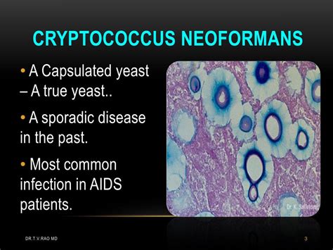 PPT - Cryptococcus neoformans PowerPoint Presentation - ID:182746