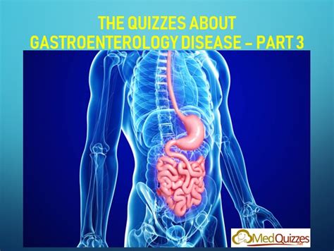 The Quizzes about Gastroenterology diseases – Part 3 (27 test) - MedQuizzes