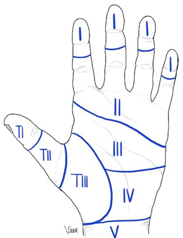 Flexor Tendon Repair - Surgical Repair - TeachMeSurgery