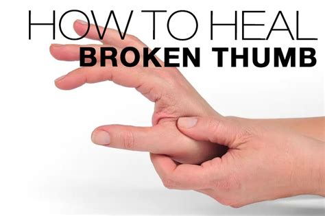 Broken Thumb: Symptoms, Causes, Treatment By Wrist & Thumb Braces