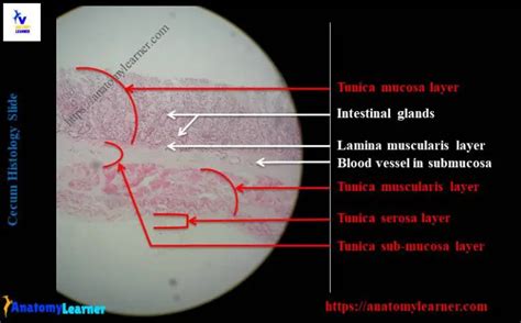 Cecum Histology Slide with Labeled Image and Diagram » AnatomyLearner ...