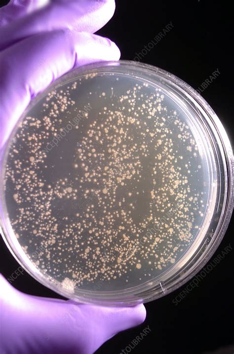 Bacterial culture - Stock Image - M874/0683 - Science Photo Library