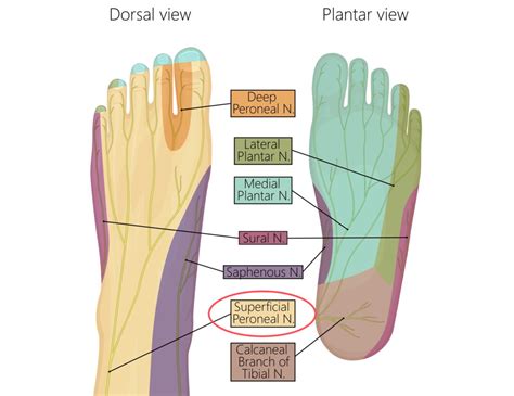 Pinched Nerve Leg Treatment