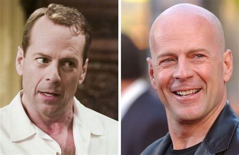 19 Bald Celebrities Before & After Embracing Baldness