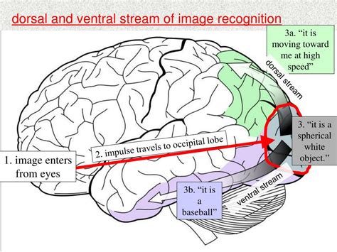 Visual Agnosia Brain