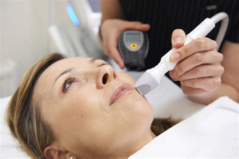 IPL Vs. Lasers: What’s the Difference? - Radiance Skincare & Laser Medspa