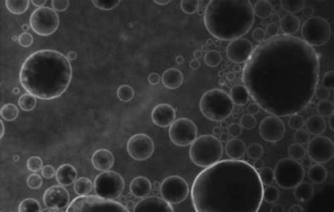 Microbubbles and ultrasound open the blood-brain barrier to administer ...