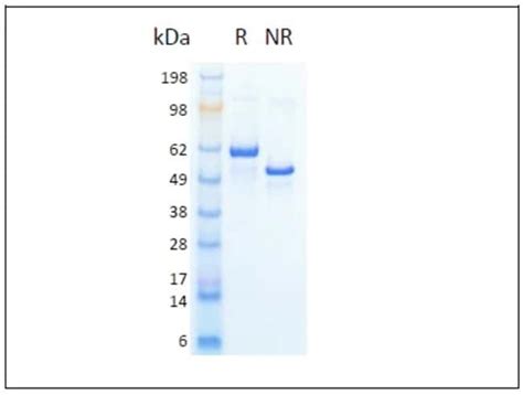 Proteintech™ HumanKine™ Recombinant Human HSA Protein: | Fisher Scientific