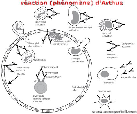 Phénomène d'Arthus : définition et explications