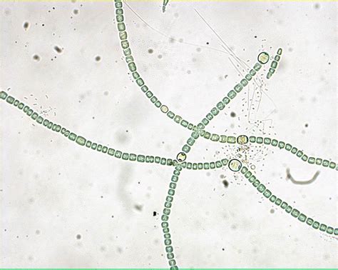 Anabaena 400X: General Biology Lab: Loyola University Chicago