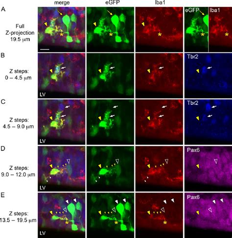 Microglial cells simultaneously perform multiple tasks: a single... | Download Scientific Diagram