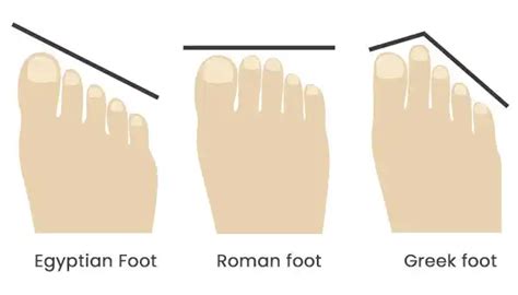 Foot shape : differences in morphology | Podexpert