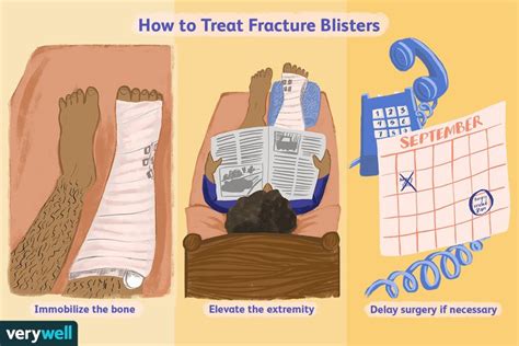 Skin Blisters After Severe Fractures Are Often Expected