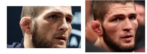 Explaining the Weird UFC Fighter Ears [with Examples] - BJJaccessories