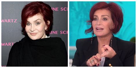 Check Out Sharon Osbourne Before and After Her Facelift: Pictures