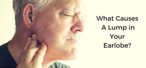 8 Causes & Treatments for Lump in Earlobe | Daily Health Cures