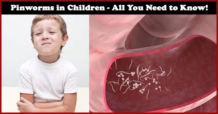 Pinworms in Children - All You Need to Know!