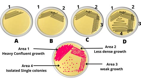 Streak Plate Method- Principle, Types, Methods, Uses, 46% OFF