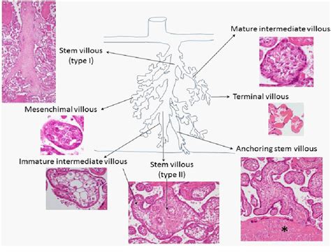 Figure 5 from Histology of Human Placenta | Semantic Scholar