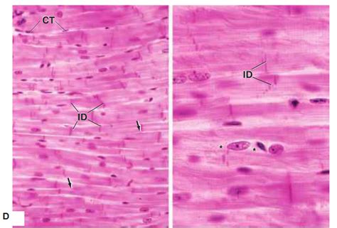 Cardiac Muscle Histology Cross Section - Draw-thevirtual