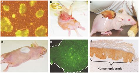 Critical steps for successful long-term transgenic human skin... | Download Scientific Diagram