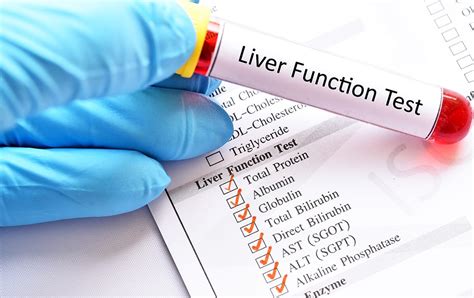 Abnormal Liver Blood Tests | Oxford Gut and Liver