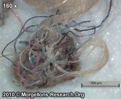 Morgellons Morphology