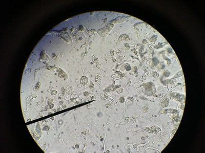 Trichonympha - Definition, Classification and Characteristics | Cell ...