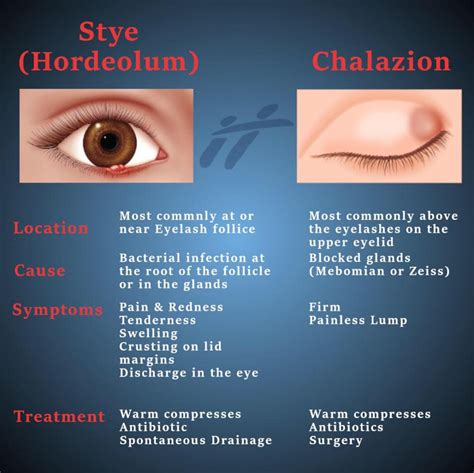 The best way to tell the difference... - Heritage Hospital