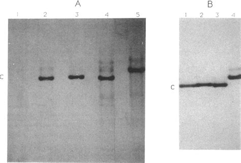 Acrylamide gel electrophoretic analysis of acid-soluble proteins from ...