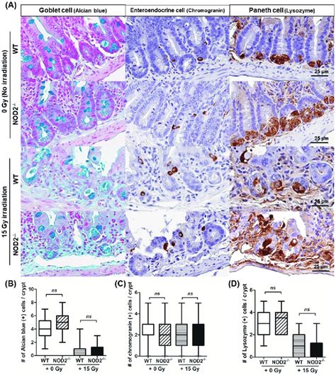 Immunohistochemical staining for goblet cells, enteroendocrine cells,... | Download Scientific ...