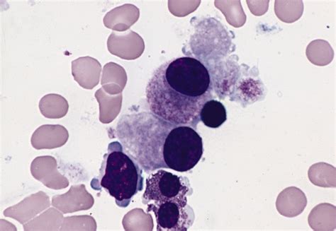 Platelets - HEMATOLOGY