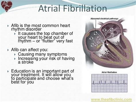 Symptoms of atrial fibrillation - PT Master Guide