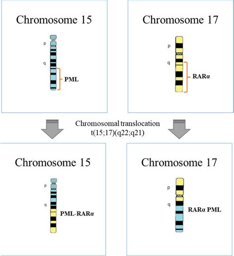 Schematic representation of chromosomal translocation t(15;17)(q22;q21)... | Download Scientific ...