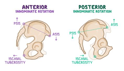 Diagnosing pelvis somatic dysfunction | Osmosis