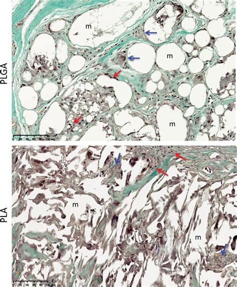 Histology of subcutis implants in rats of the synthetic PLGA bi-layered ...