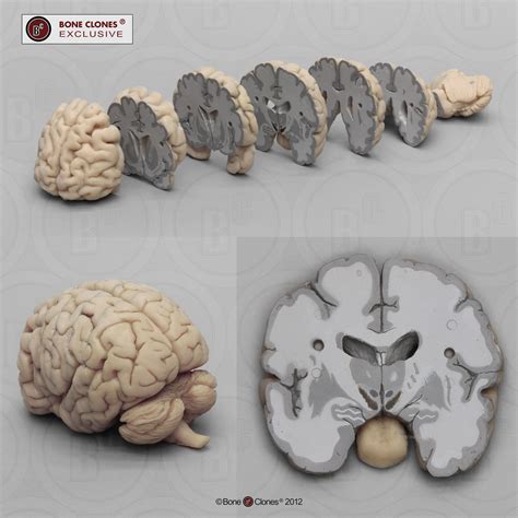 Human Brain Multiple Coronal Sections - Bone Clones - Osteological ...