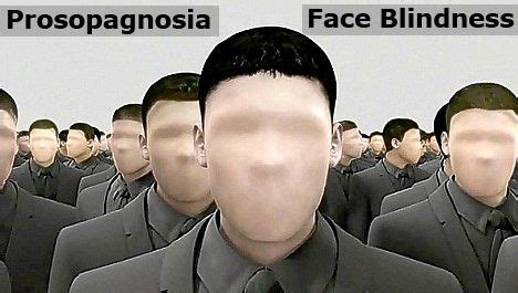 Hot on internet: Prosopagnosia or face blindness treatment