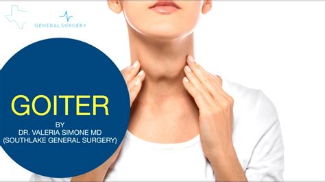 Goiter – Causes, Symptoms, Treatment, and Surgery - YouTube