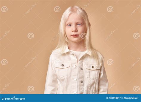 Awesome Albino Kid with Blonde Hair, Isolated Stock Image - Image of ...