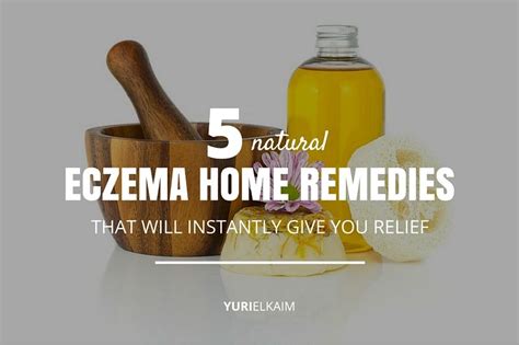 5 Home Remedies for Eczema That Will Relieve Itchiness | Yuri Elkaim