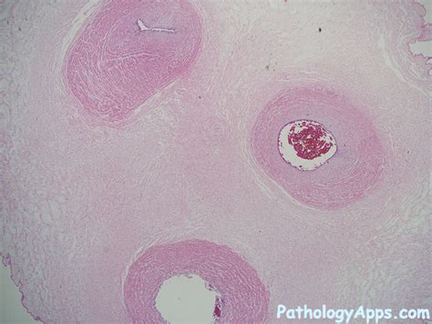 cord placenta histology