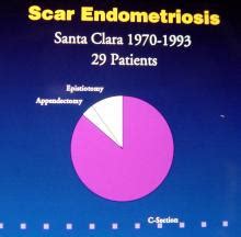 Endometriosis | Surgery Photos